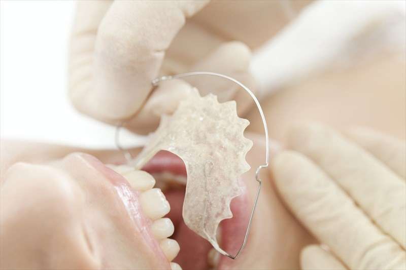 歯の機能も見た目の美しさも保つ高度な治療